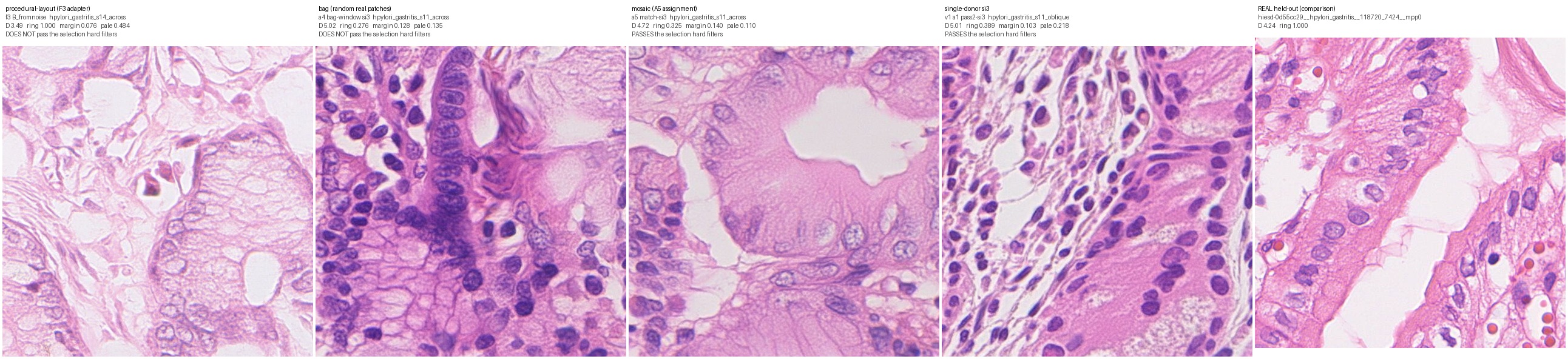 Best per family, gastritis